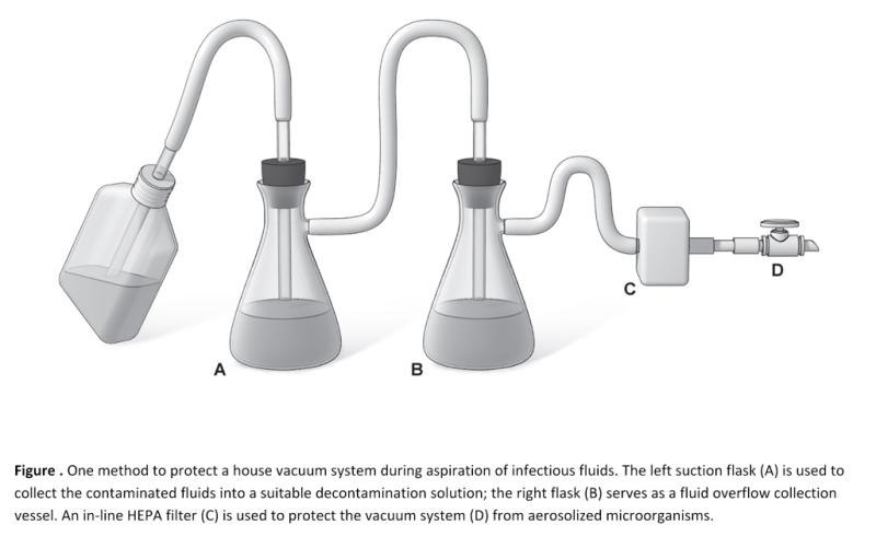 Figure of Vacuum Flask System